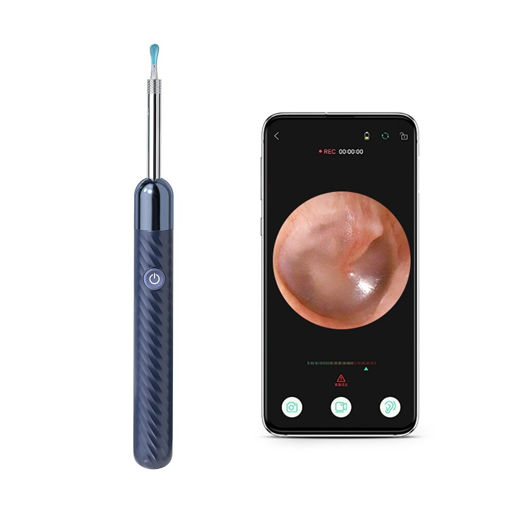 INSKAM X6 HD Wireless WiFi Otoscope: Intelligent, Waterproof Visual Inspection