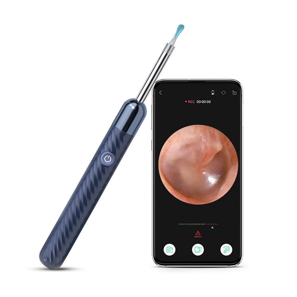 INSKAM X6 HD Wireless WiFi Otoscope: Intelligent, Waterproof Visual Inspection