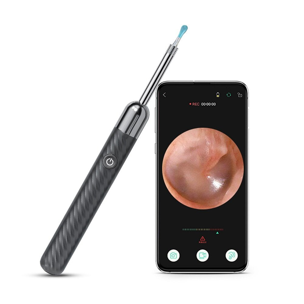 INSKAM X6 HD Wireless WiFi Otoscope: Intelligent, Waterproof Visual Inspection